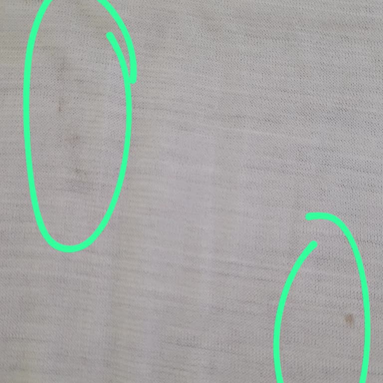 Lekeli Yün Atelde Hijyen Nedeniyle İade Reddi Ve Trendyol’un İhmali