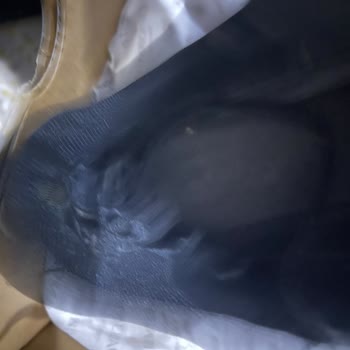 Garanti Reddi Ve Kullanıcı Hatası İddiasıyla Ayıplı Ayakkabı Şikayeti