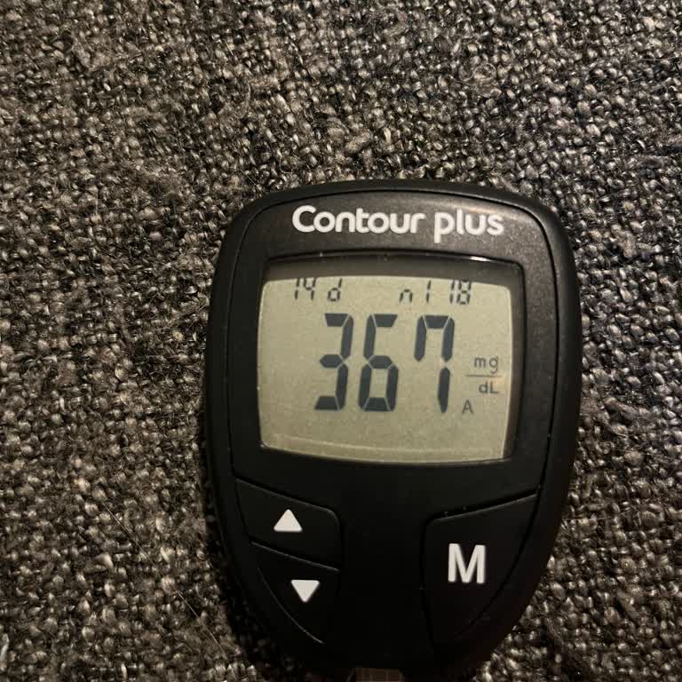 G7 Sensör Ölçüm Hatası Ve Değişim Talebinin Reddedilmesi