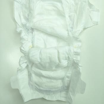 Molfix Bebek Bezi Paketinde Cırtcırt Eksikliği, Kalite Güvencesi Sarsıldı