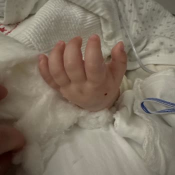 Ankara Etlik Şehir Hastanesi Hemşire Gece Uyuyarak Çocuğumun Şişen Damar Yolunu İhmal Etti