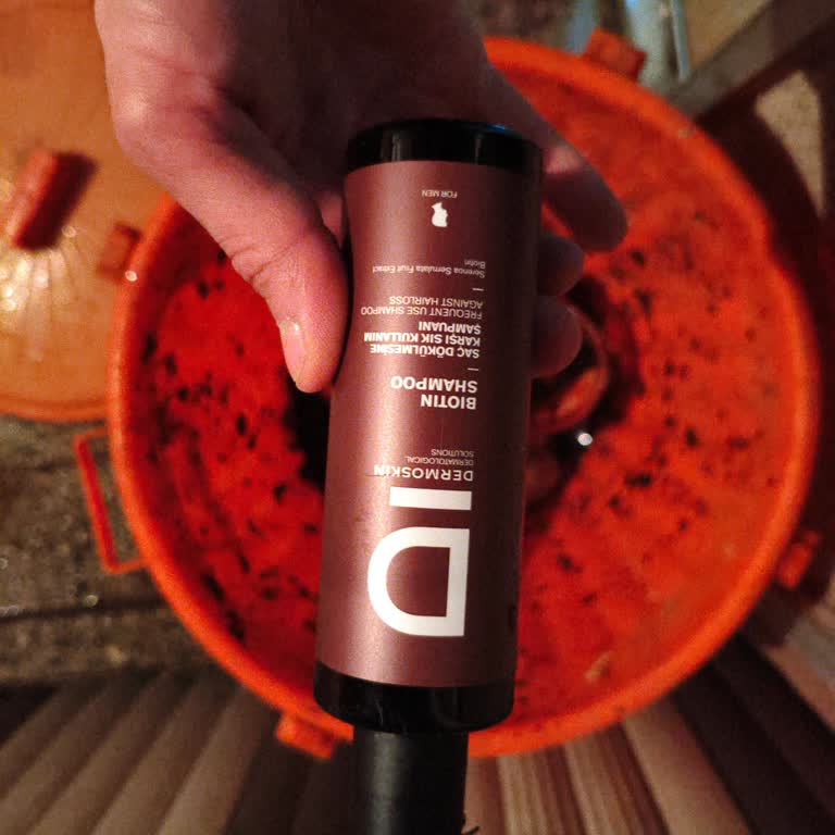 Dermoksin Şampuanı Sonrası Şiddetli Saç Dökülmesi Ve Kaşıntı