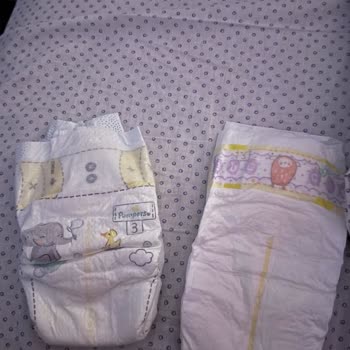 Şok Online’da Aldığım Prima Premium Care Bezlerinin Sahte Ve Süresi Geçmiş Olması