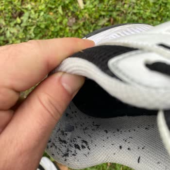 5.600 TL'lik Skechers Ayakkabısı 20 Günde Yırtıldı, Garanti Reddi