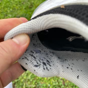 5.600 TL'lik Skechers Ayakkabısı 20 Günde Yırtıldı, Garanti Reddi