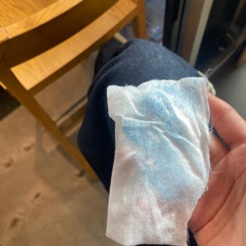 Mango Jean Pantolonunda Boya Sızıntısı Ve Ücret İadesi Talebi