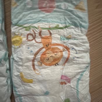 Islaklık Göstergesi Olmayan Ve Bacak Lastikleri Cildi Tahriş Eden Prima Aktif Bebek Bezleri Şikayeti