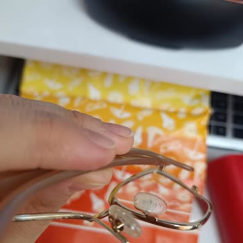 İlgisiz Personel Ve Kirli Teşhir Gözlüğüyle Karşılaştığım Sorun