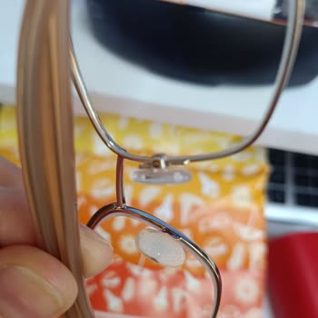 İlgisiz Personel Ve Kirli Teşhir Gözlüğüyle Karşılaştığım Sorun