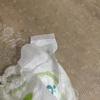 Bantı Olmayan Bebek Bezleri Sebebiyle Sürekli Mağduriyet