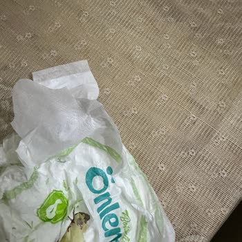 Bantı Olmayan Bebek Bezleri Sebebiyle Sürekli Mağduriyet