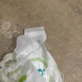 Bantı Olmayan Bebek Bezleri Sebebiyle Sürekli Mağduriyet