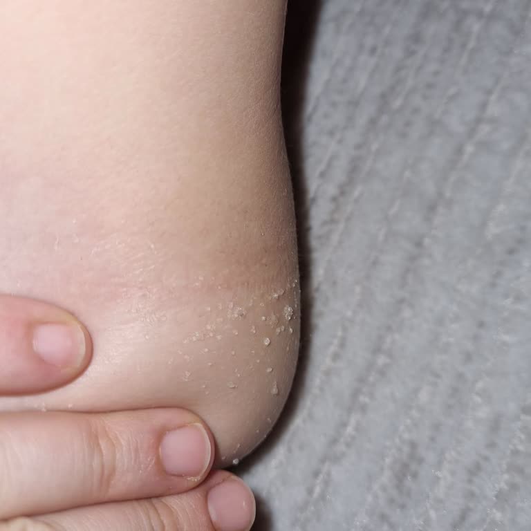 Molfix X Bebek Bezinde Jel Sızıntısı ve Trendyol’un İade Süreci İhmali