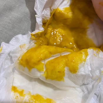 Sleepy Doğal 3 Numaralı Bez Sızdırma Ve Emicilik Sorunu Bebeğimde Pişik Oluşumuna Neden Oluyor