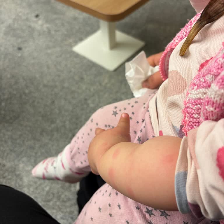 Damar Yolu Açma Hatası Sonucu Çocuğumun Kolunun Şişmesi Ve Hastane Personelinin Sorumsuz Tutumu