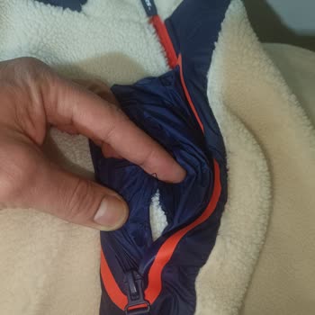 Cekette Dikiş Hataları Ve 28 Gün Bekleme Sürecine Karşı Değişim İsteği