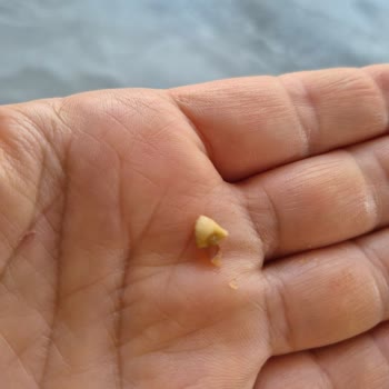 BİM Soğuk Baklava İçindeki Sert Parçalar Çocuğumu Tehlikeye Attı