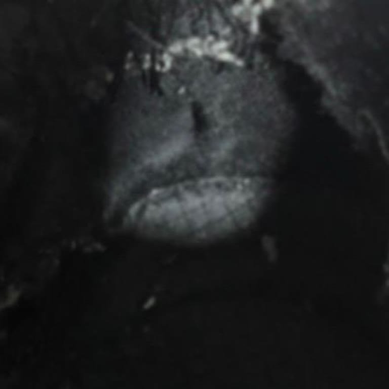 Garanti Süresinde Deri Soyulması Sorunu Yaşayan Skechers Ayakkabısının Değişim Talebi