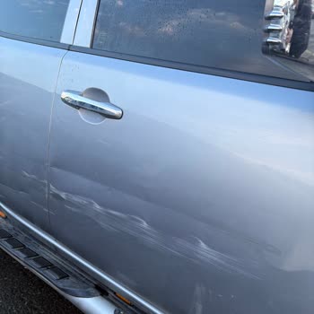 Rize Eğitim Hastanesi Otoparkında Araç Çizilmesi Ve Sorumluluk Reddi