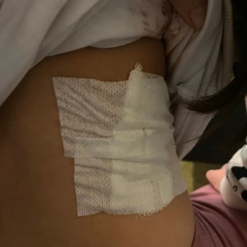 Paslı Demir Çocuk Oyun Alanında Yaralanmaya Yol Açtı