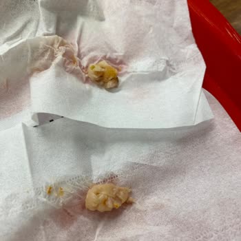 Yaprak Dönercisi Çiğ Tavuk Döner Ve Tekrarlayan Hijyen Sorunları Nedeniyle Ücret İadesi Talebi