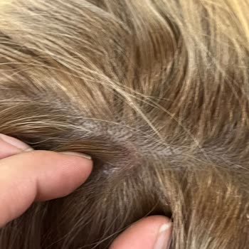 Elit Kuaför (Eryaman) Saç Boyama İşleminde Kesilme, Yanma