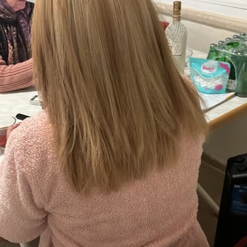 Elit Kuaför (Eryaman) Saç Boyama İşleminde Kesilme, Yanma