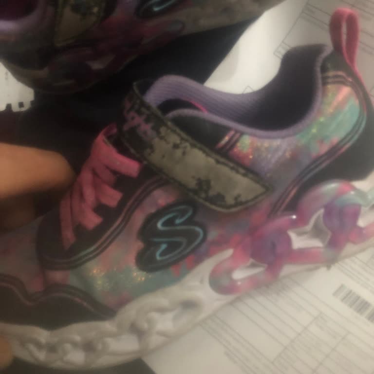 Skechers Ayakkabısının Cırt Cırt Kısmı 2 Ayda Deforme Oldu, Değişim Talebi Reddedildi