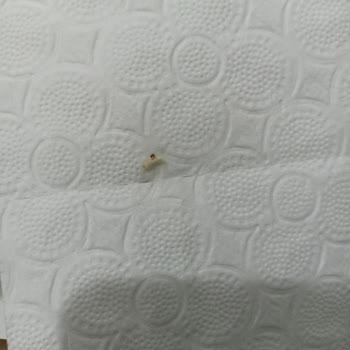 Tuvalet Kağıdında Kurt Görülmesi Aile Sağlığını Tehdit Ediyor