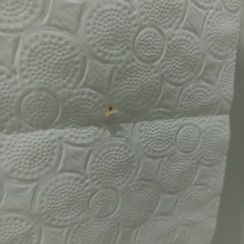 Tuvalet Kağıdında Kurt Görülmesi Aile Sağlığını Tehdit Ediyor