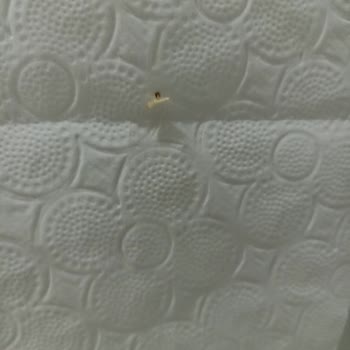 Tuvalet Kağıdında Kurt Görülmesi Aile Sağlığını Tehdit Ediyor