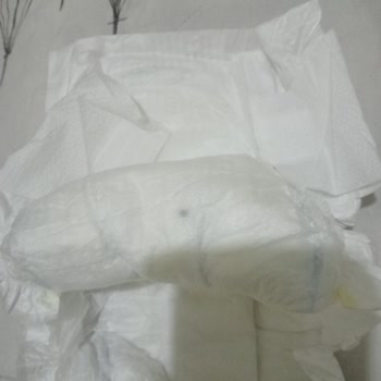 Molfix Bebek Bezinde Yabancı Madde Bulunması Endişe Yarattı