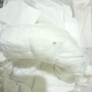 Molfix Bebek Bezinde Yabancı Madde Bulunması Endişe Yarattı