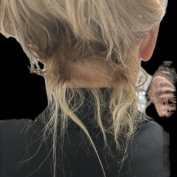 Saç Boyama İşleminde Yanık Ve Faturasız Ödeme İadesi Talebi