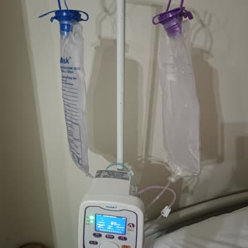 Arızalı PEG Makinesi Ve Bozuk Mama Torbaları Nedeniyle Mağduriyet, SGK Kayıt İptali Talebi