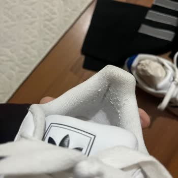 Sadece Üç Kez Kullanılan Adidas Superstar’da Topuk Pamuklanması Ve Yırtılma Riski