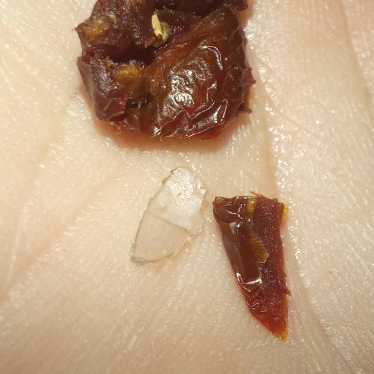 Metro Chef Domates Kurusu'nda Sert Plastik Parçası Yutuldu