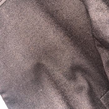 Tek Kullanımda Aşırı Tüylenme Ve Cevapsız Müşteri Hizmetleri