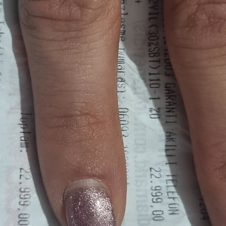 Media Markt Kasko Telefon Tamiri 20 Gün İçinde Gerçekleşmedi