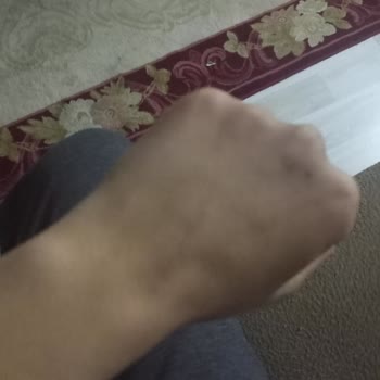 Antalya Eğitim Araştırma Hastanesi Kaba Üslup ve Yanlış Yönlendirme: MR Randevumda Yaşadığım Sorun