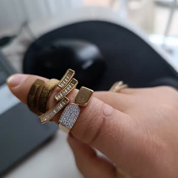 Çelik Olduğu Söylenen Yüzükler Parmakta Yeşillenmeye Neden Oldu Ve Firma Geri Dönüş Yapmadı