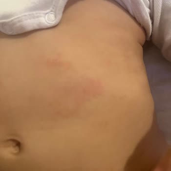 Mustela Bebek Şampuanı Ve Yağı Egzama Yaratıyor, Ücret İadesi İstiyorum