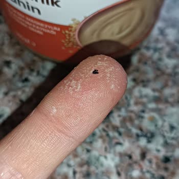 Wefood Organik Tahin Kavanozunda Bulunan Siyah Elastik Yabancı Madde Güveni Ve Sağlığı Tehdit Ediyor