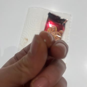 Eti Gıda Yerken İçinden Bir Şey Çıktı Ve Dişim Kırıldı