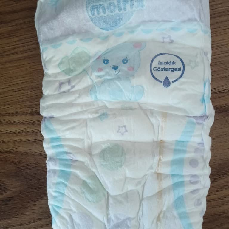 Molfix Extra Large Bebek Bezinde Sürekli Sızıntı Ve Değişim İsteği