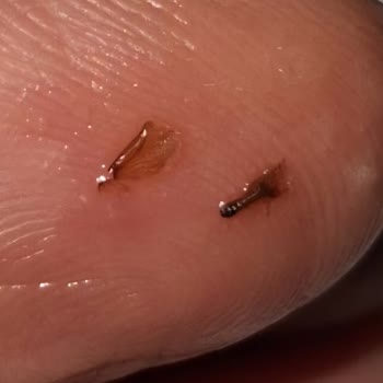 Zeytinyağlı Enginar Konservesinde Böcek Tespiti Ve Hijyen Endişesi