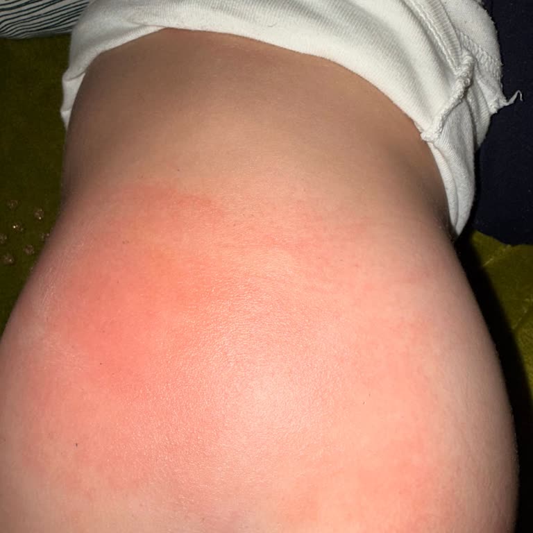 Migros Minies 6 Numaralı Bezinde Çocuğumda Şiddetli Alerji