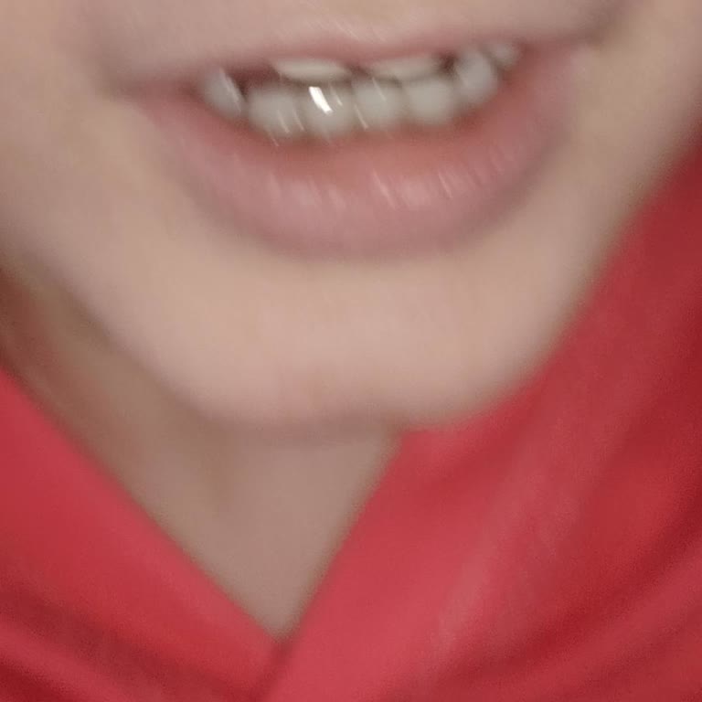 İKEA Kartal Çocuk Oyun Alanında Tek Görevli Nedeniyle Çocuğumun Burnu Çizildi Ve Gözetim İhmali