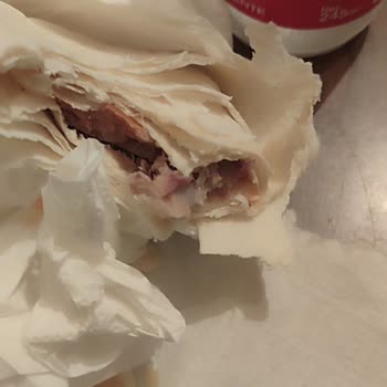 Getir Üzerinden Kuzu Kelle Paketi İçinde Diş Ve Cevapsız Müşteri Hizmeti