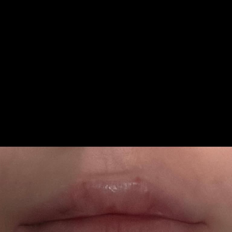 Tunçsiper Beauty Kızıma, Onayım Alınmadan Dolgu Yapılmış!